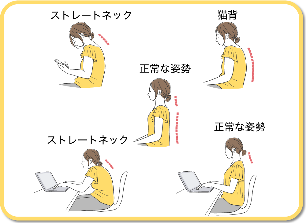 姿勢の良い人、悪い人のイラスト