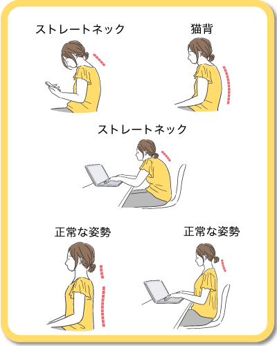 姿勢の良い人、悪い人のイラスト