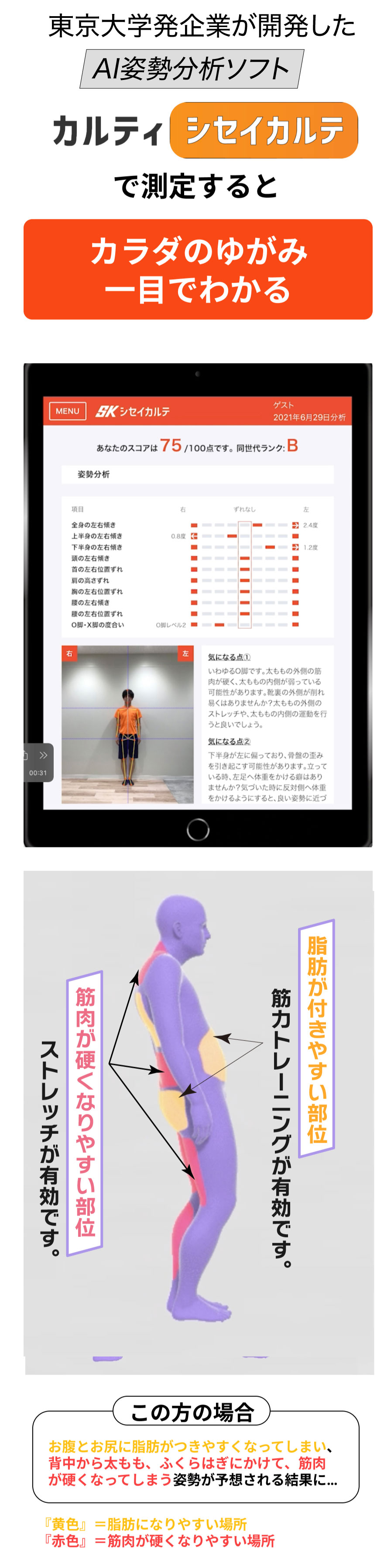 カラダのゆがみ一目でわかる