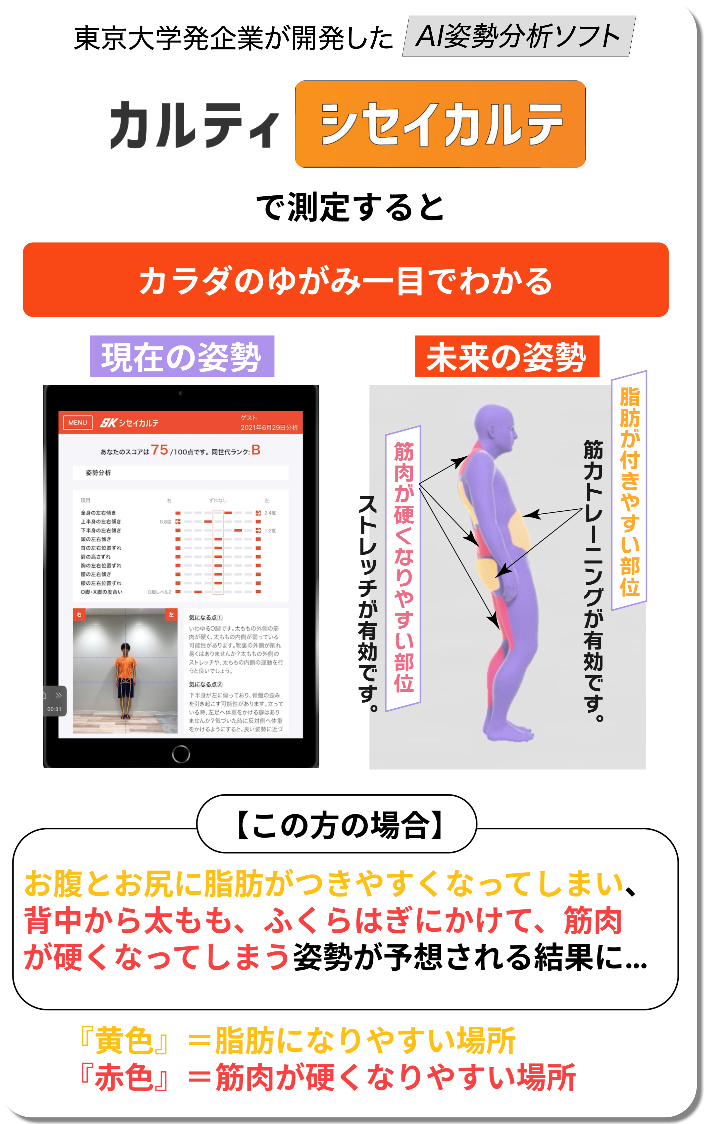 カラダのゆがみ一目でわかる